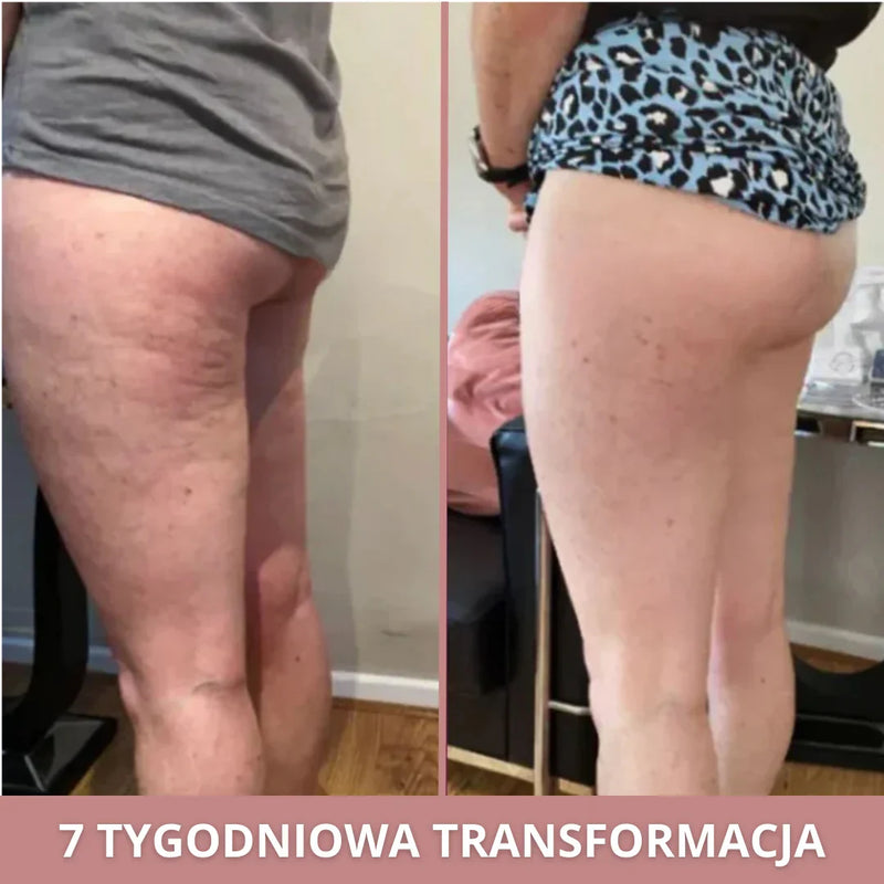 Anna (36 anni)